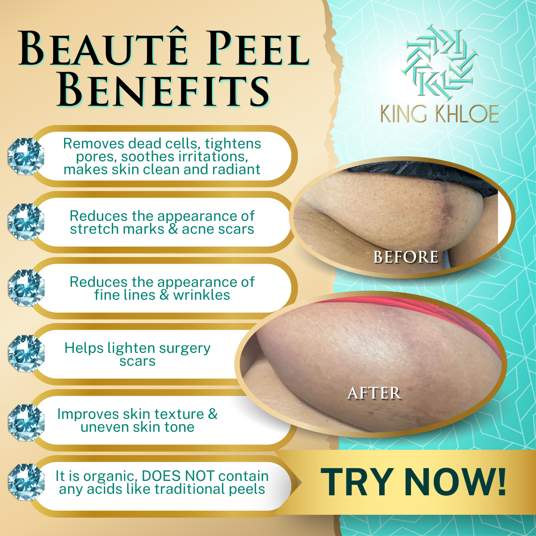 Beauté Peel Training